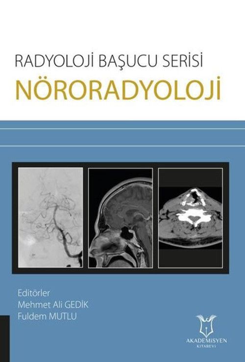 Nöroradyoloji - Radyoloji Başucu Serisi