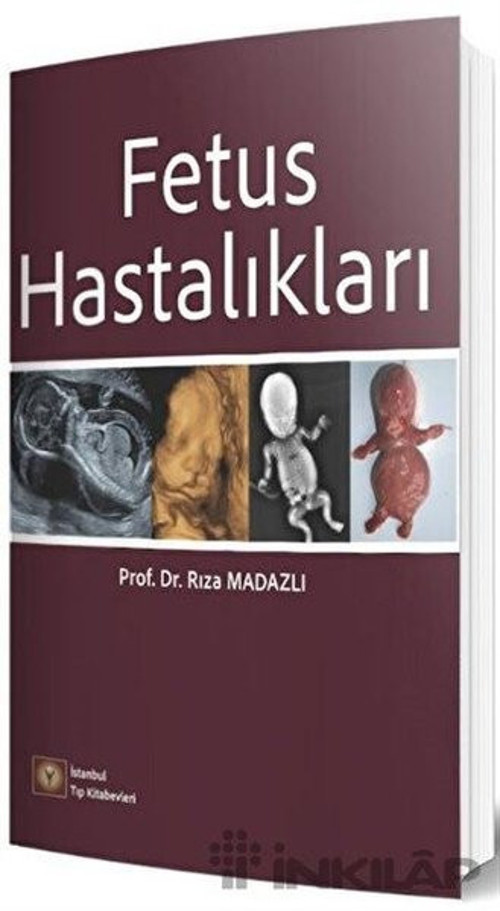 Fetus Hastalıkları