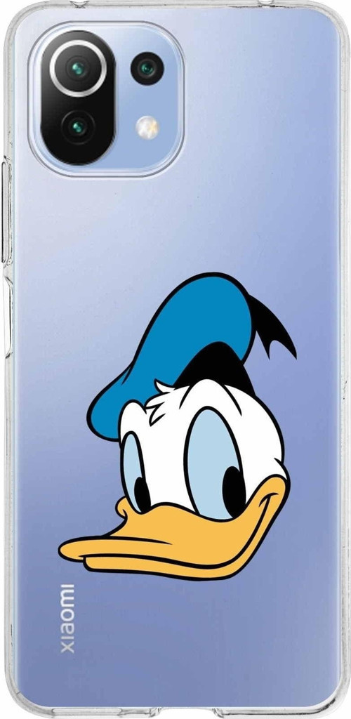 Xiaomi Mi 11 Lite Uyumlu Kapak Donald Duck Tasarımlı Şeffaf Silikon Kılıf