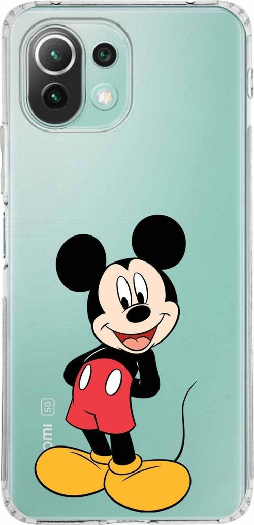 Xiaomi Mi 11 Lite Kamera Korumalı Kapak Mickey Mouse Tasarımlı Şeffaf Kılıf