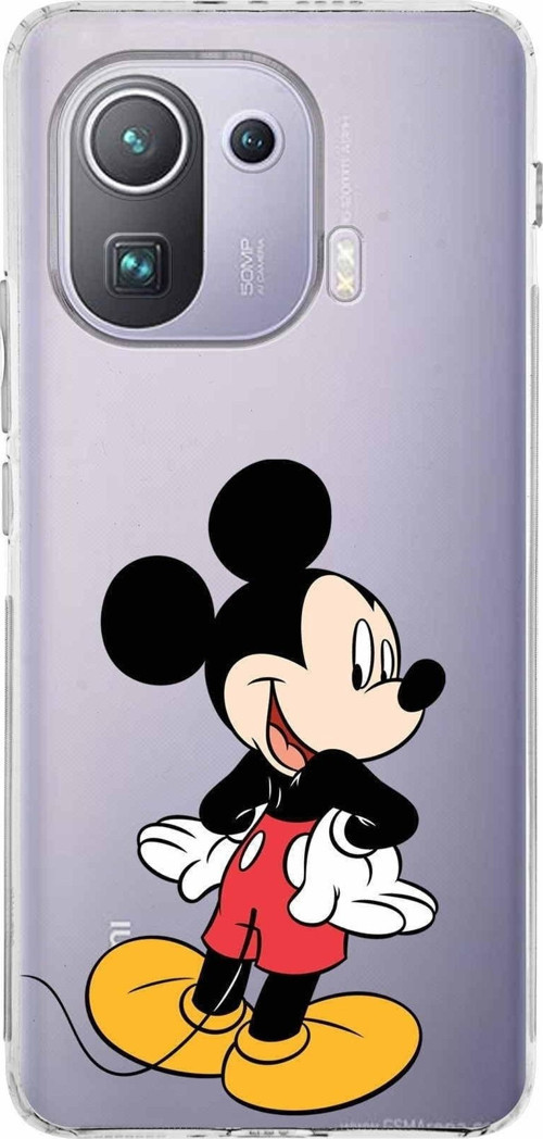 Xiaomi Mi 11 Pro Kamera Korumalı Kapak Mickey Mouse Tasarımlı Şeffaf Kılıf