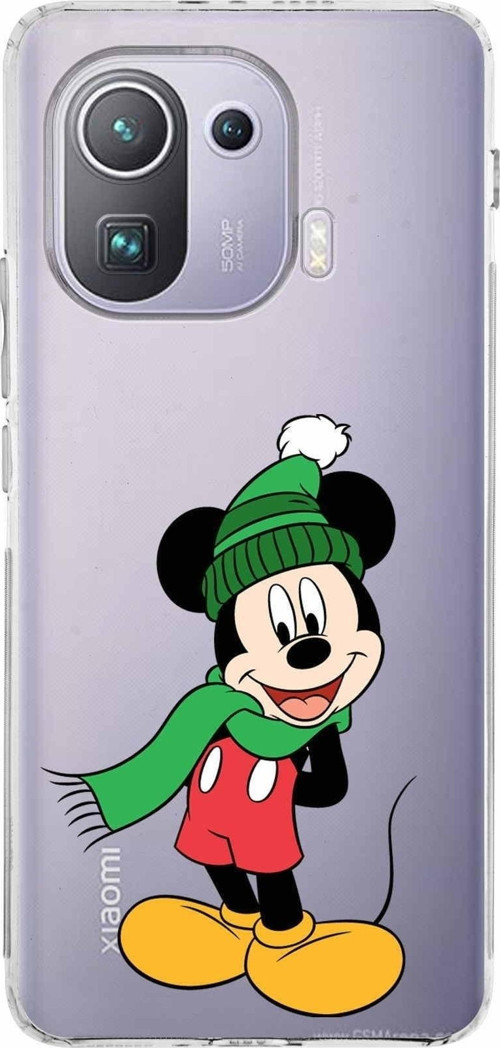 Xiaomi Mi 11 Pro Kamera Korumalı Kapak Mickey Mouse Tasarımlı Şeffaf Kılıf