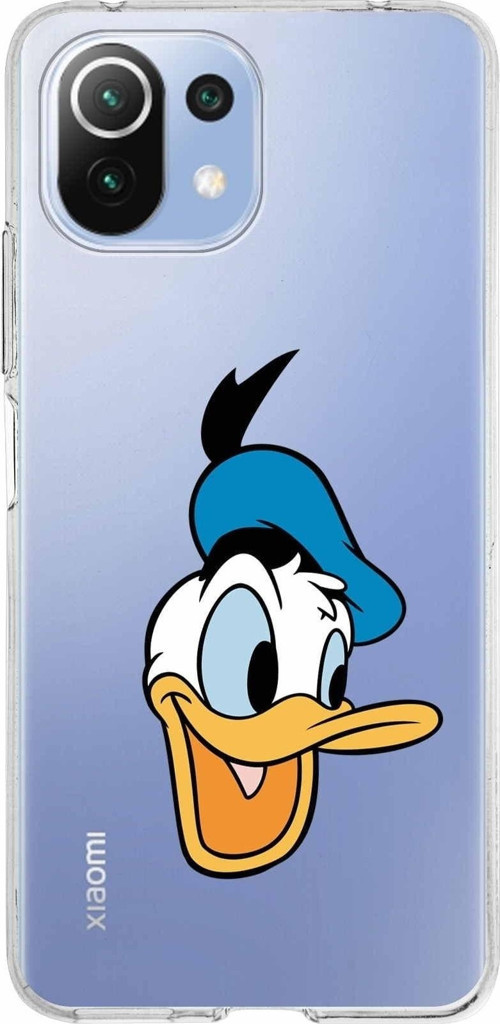 Xiaomi Mi 11 Lite Uyumlu Kapak Donald Duck Tasarımlı Şeffaf Silikon Kılıf