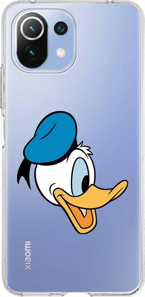 Xiaomi Mi 11 Lite Uyumlu Kapak Donald Duck Tasarımlı Şeffaf Silikon Kılıf
