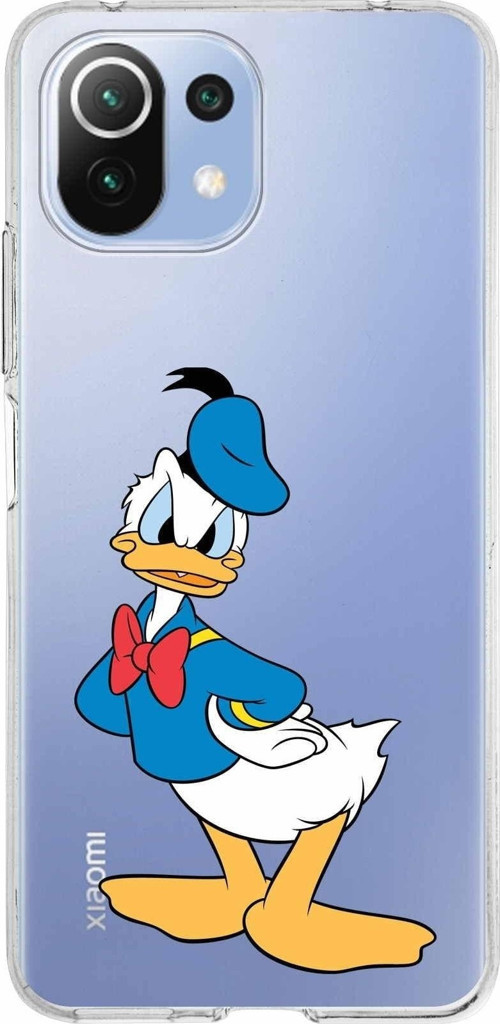 Xiaomi Mi 11 Lite Uyumlu Kapak Donald Duck Tasarımlı Şeffaf Silikon Kılıf