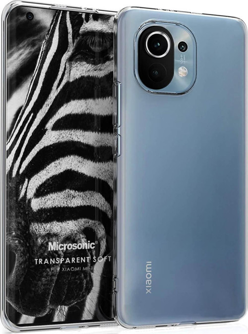 Xiaomi Mi 11 Kılıf Transparent Soft Beyaz