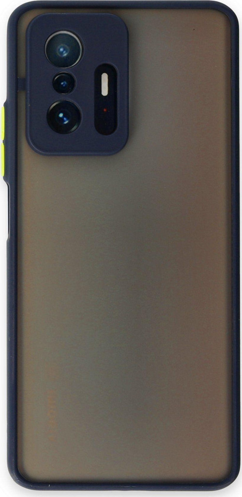 Xiaomi Mi 11T Pro Kılıf Kamera Korumalı Silikon Renkli Düğmeli Arkası Mat Arka Kapak - Lacivert