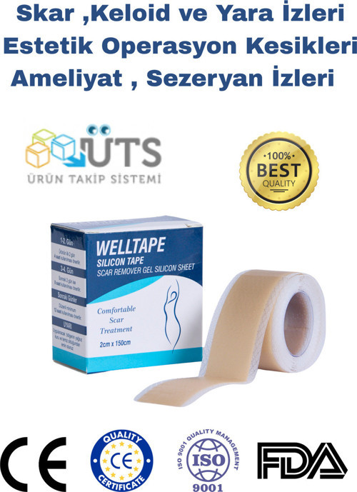 Soft Silikon Bant - Ameliyat Izi Giderici - Sezaryen - Yanık - Estetik 2Cm X 1,5Mt