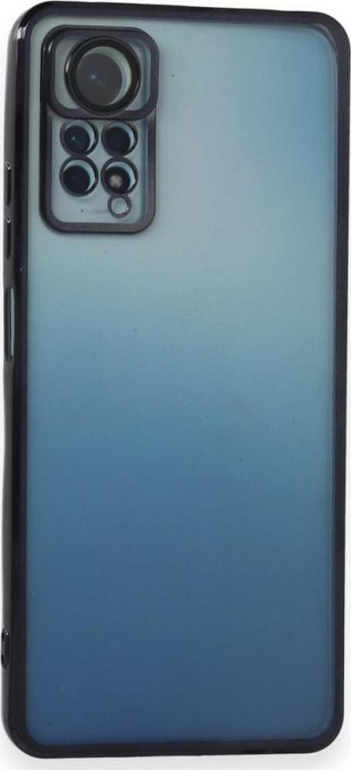 Xiaomi Redmi Note 11 / 11s Kılıf Razer Lens Çerçeveli Silikon Kapak