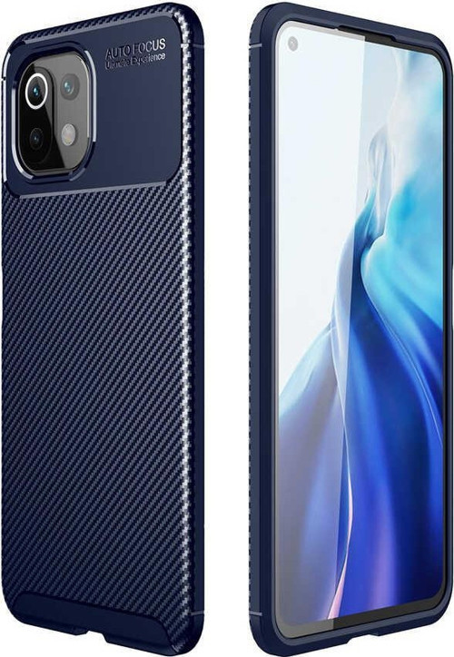 Xiaomi Mi 11 Lite Kılıf Darbe Emici Uzun Ömürlü Parmak İzi Yapmaz Karbon Tasarım Negro Kılıf