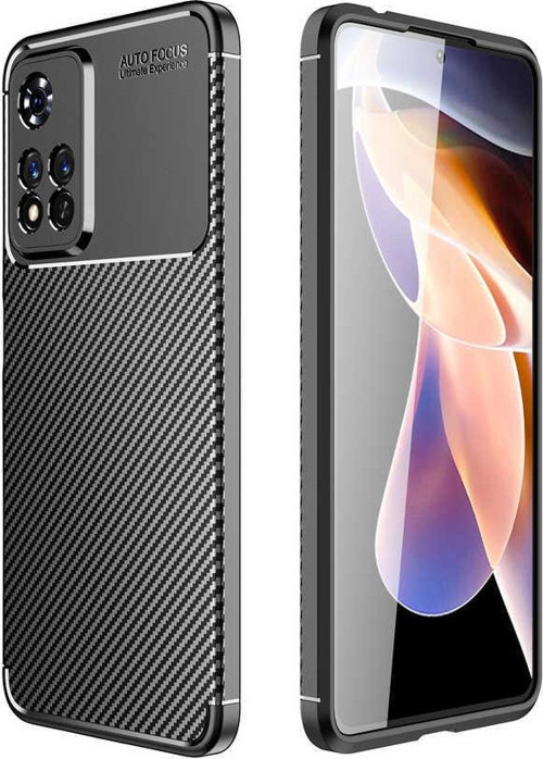 Xiaomi Redmi Note 11 Pro Plus 5G Kılıf Darbe Emici Parmak İzi Yapmaz Karbon Tasarım Negro Kılıf