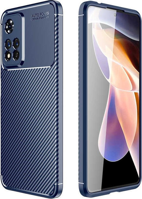 Xiaomi Redmi Note 11 Pro Plus 5G Kılıf Darbe Emici Parmak İzi Yapmaz Karbon Tasarım Negro Kılıf