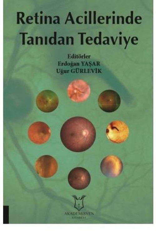 Retina Acillerinde Tanıdan Tedaviye