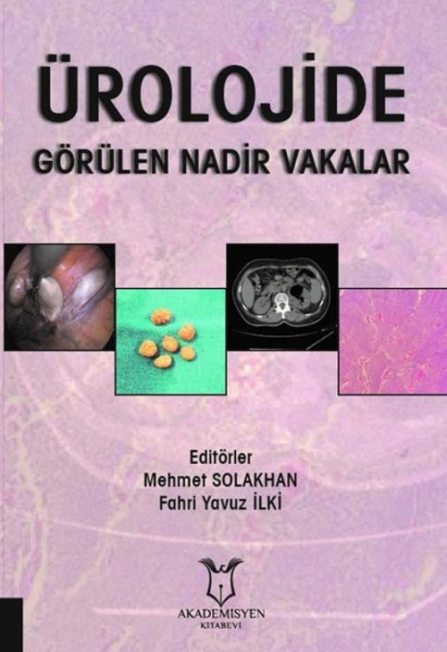 Ürolojide Görülen Nadir Vakalar