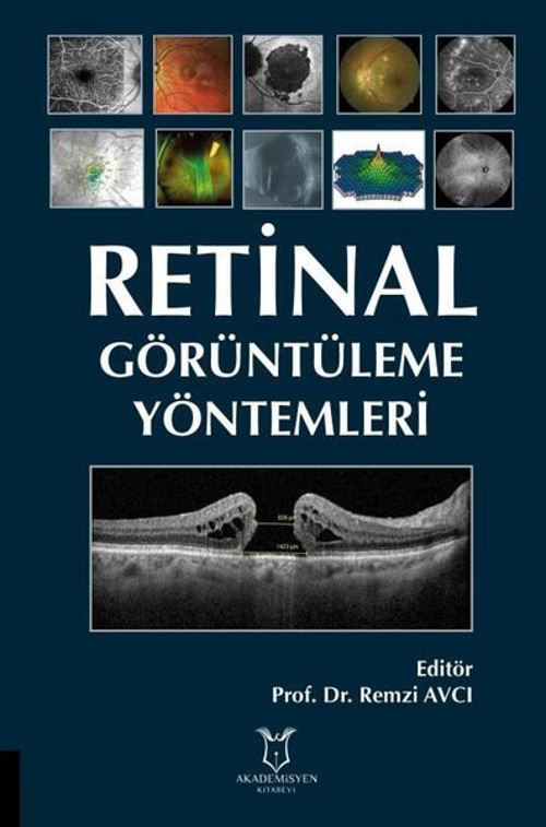 Retinal Görüntüleme Yöntemleri