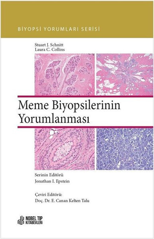 Meme Biyopsilerinin Yorumlanması