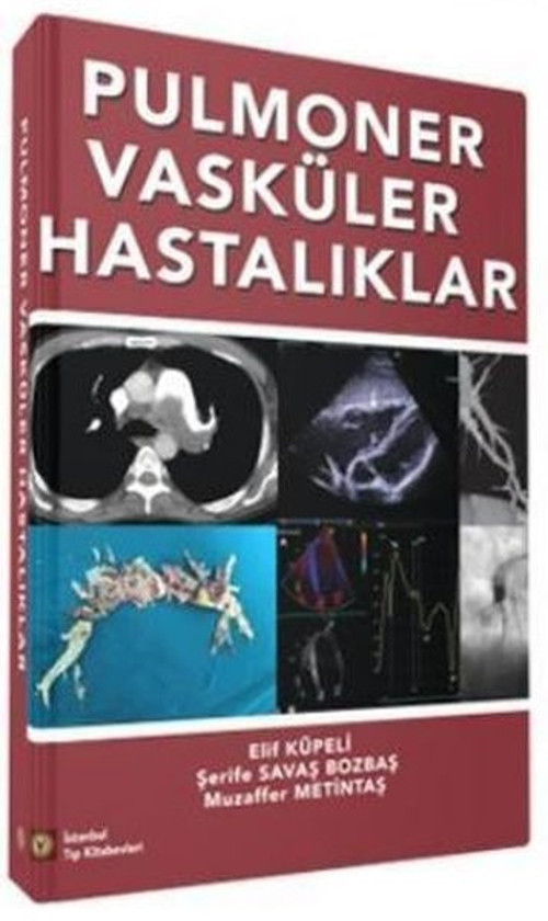 Pulmoner Vasküler Hastalıklar