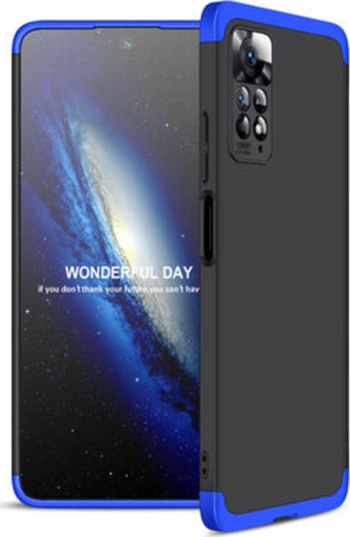 Redmi Note 11 Pro 5G 3 Parçalı Tam Koruma Şık Astrea Premium Sert Kılıf