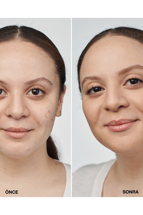 Even Better Clinical™ Serum Fondöten Spf 20 - Renk: Cn 52 Neutral (MF) - 30ml