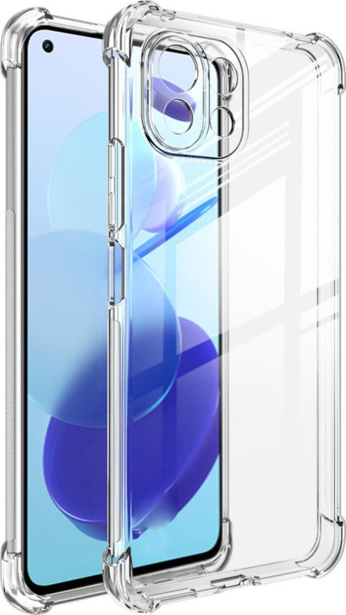 Xiaomi Mi 11 Lite 5G Kapak Kamera Korumalı Antişok Airbag Köşe Korumalı Silikon Şeffaf Kılıf