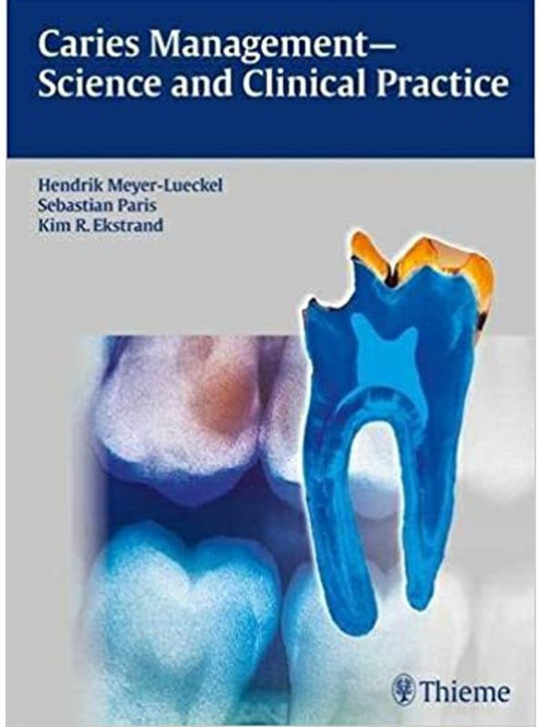 Carıes Management Scıence And Clınıcal Practıce - Thieme