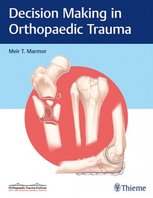Decısıon Makıng In Orthopaedıc Trauma - Thieme