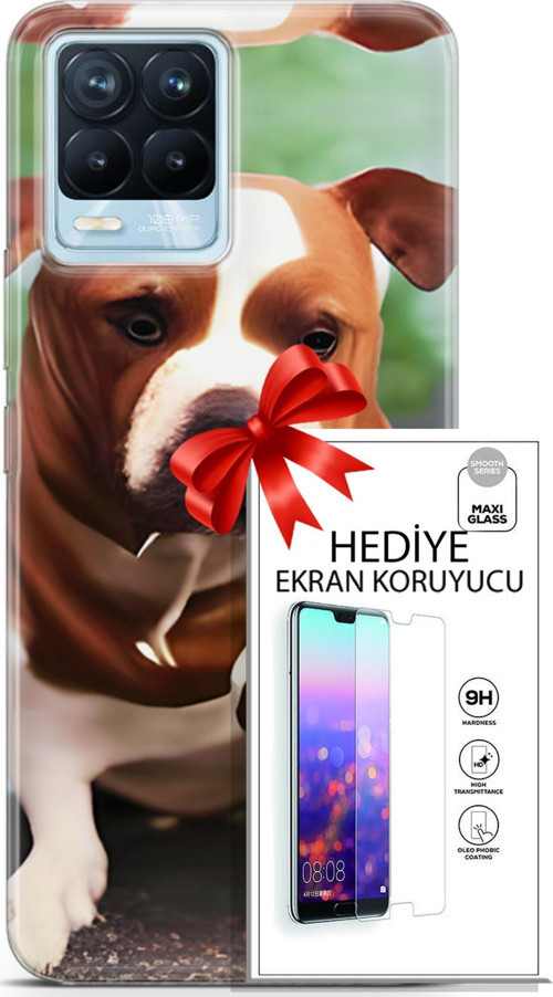 Realme 8 Pro Kılıf Orijinal Seri Dogs 29 American Staffordshire Leke Tutmaz Kapak + Ekran Koruyucu