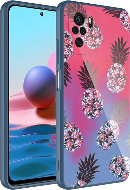 Xiaomi Redmi Note 10 Kılıf Kamera Korumalı Desenli Sert Silikon Epoksi Kapak