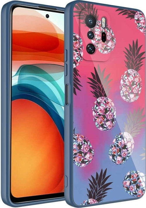 Xiaomi Redmi Note 10 Pro Kılıf Kamera Korumalı Desenli Sert Silikon Epoksi Kapak