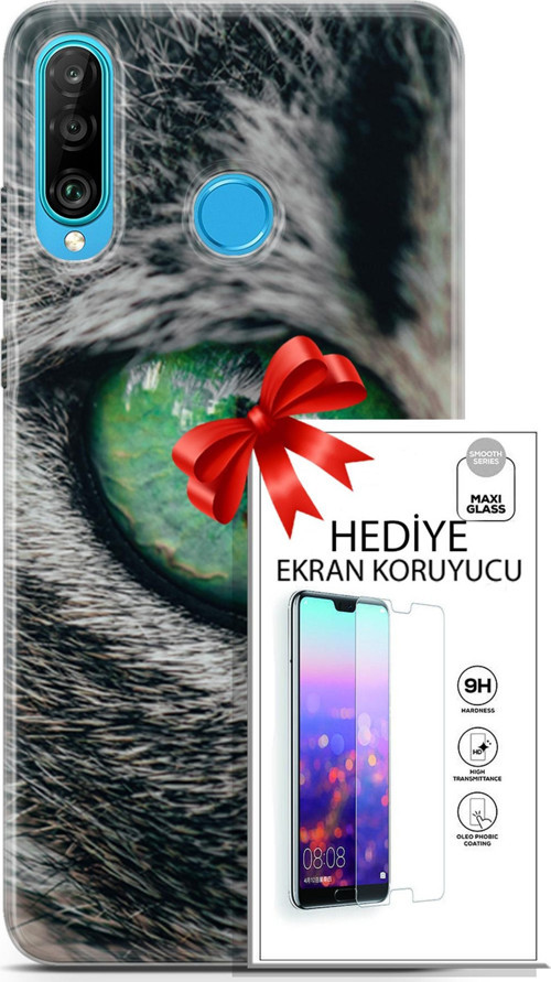 Huawei P30 Lite Kılıf Orijinal Seri Scotish-British 28 Göz Detay İz Bırakmayan Kılıf + Ön Ekran Koruyucu