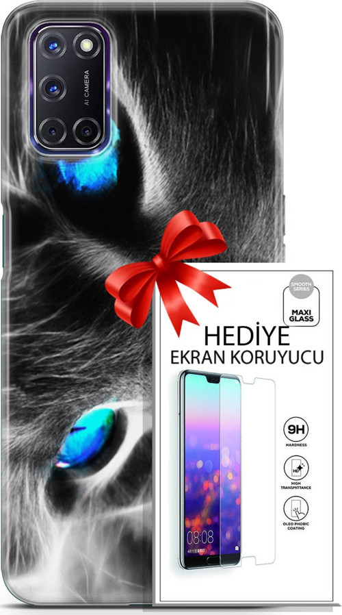 Oppo A72 Kılıf Orijinal Seri Scotish-British 26 Amerikan Kedisi Soft Kapak + Ekran Koruyucu