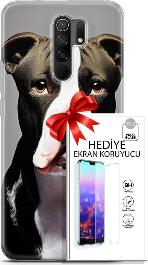 Xiaomi Redmi 9 Kılıf Orijinal Seri Dogs 24 American Pitbull Darbe Emici Kılıf + Ekran Koruyucu