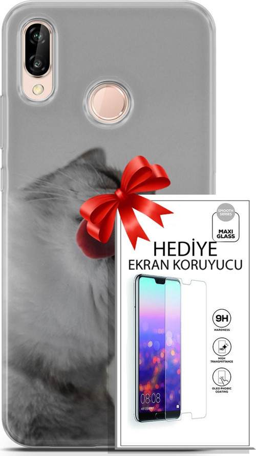 Huawei P20 Lite Kılıf Orijinal Seri Scotish-British 07 British Shorthair Desenli Kılıf + Ön Ekran Koruyucu