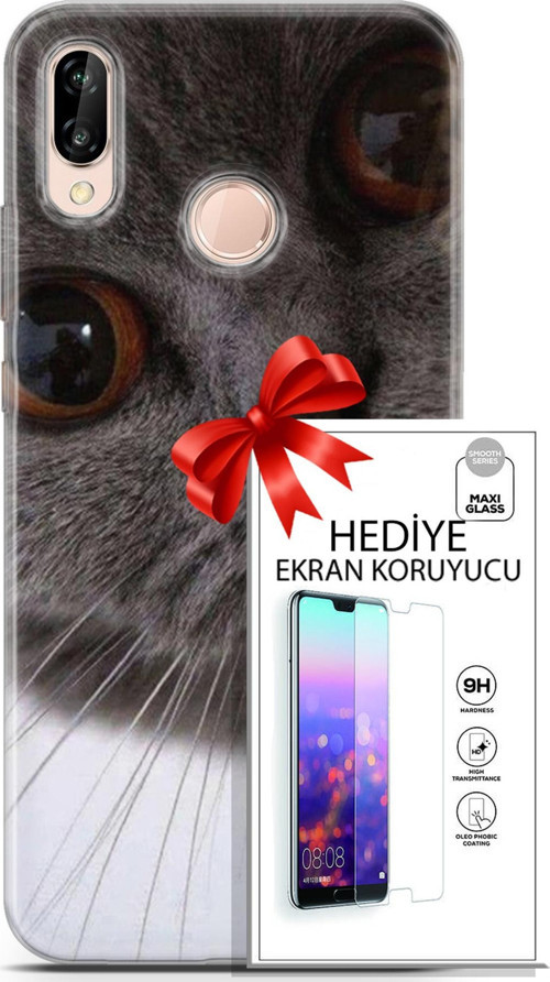 Huawei P20 Lite Kılıf Orijinal Seri Scotish-British 11 Pov British 4K Baskılı Kılıf + Ekran Koruyucu