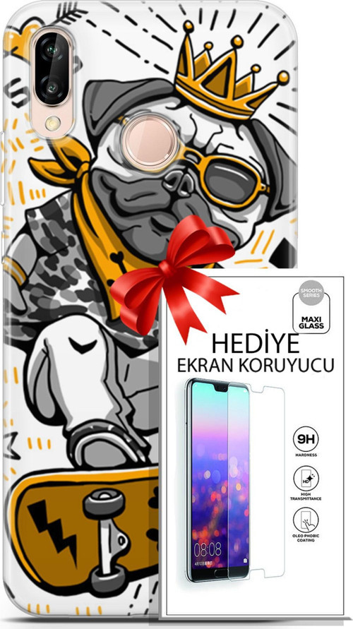 Huawei P20 Lite Kılıf Orijinal Seri Punky 09 Punk Pug Uv Kılıf Ve Ekran Koruyucu