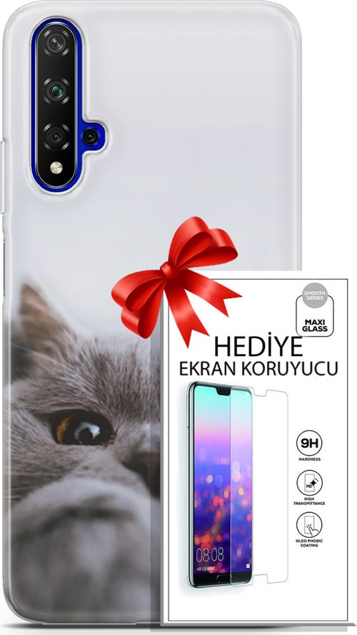Huawei Nova 5T Kılıf Orijinal Seri Scotish-British 08 Sevimli Kedi Baskılı Kılıf + Ekran Koruyucu