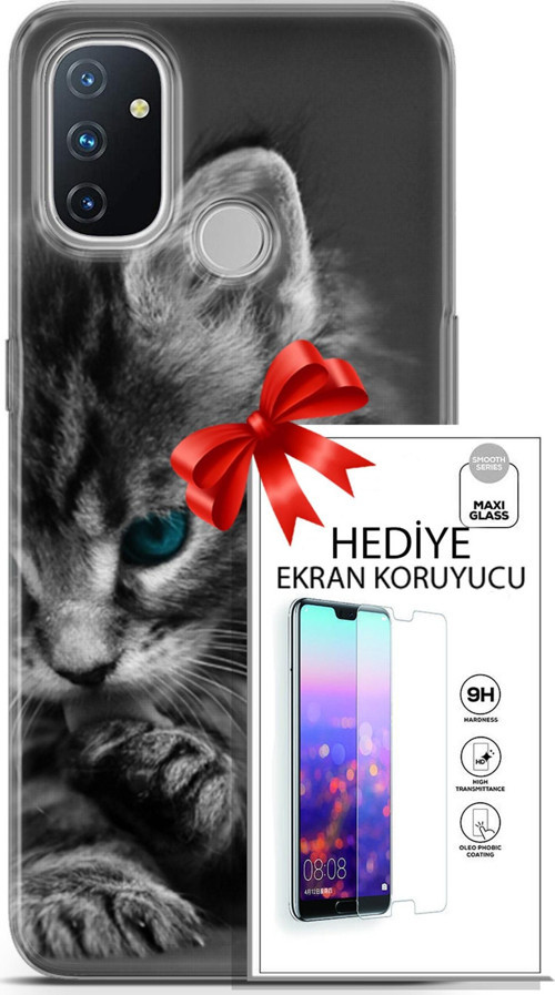 Oneplus Nord N100 Kılıf Orijinal Seri Scotish-British 19 Mavi Gözlü Ragdoll Tam Koruma Kılıf + Ekran Koruyucu