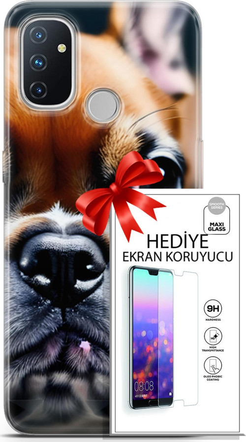 Oneplus Nord N100 Kılıf Orijinal Seri Dogs 10 İngiliz Mastiff Full Hd Kılıf + Ekran Koruyucu