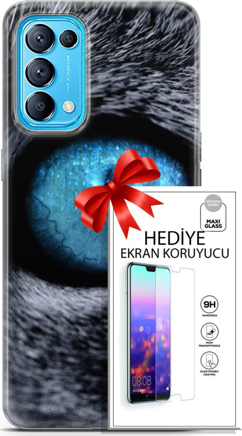 Oppo Reno 5 Pro Kılıf Orijinal Seri Scotish-British 29 Pov Eye Leke Tutmaz Kapak + Ekran Koruyucu