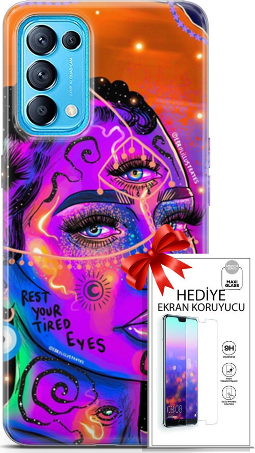 Oppo Reno 5 Pro Kılıf Orijinal Seri Cardano 04 Rest Your Tired Silikon Kılıf + Ekran Koruyucu Full Koruma