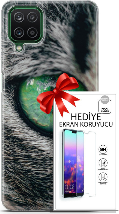 Samsung Galaxy A12 Kılıf Orijinal Seri Scotish-British 28 Göz Detay İz Bırakmayan Kılıf + Ön Ekran Koruyucu