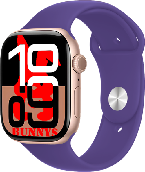 Omix X600 NFC Uyumlu KoyuMor Akıllı Saat Watch10 2025 Hediyeli AMOLED EKRAN