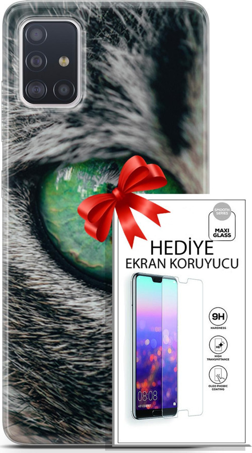 Samsung Galaxy A71 Kılıf Orijinal Seri Scotish-British 28 Göz Detay İz Bırakmayan Kılıf + Ön Ekran Koruyucu