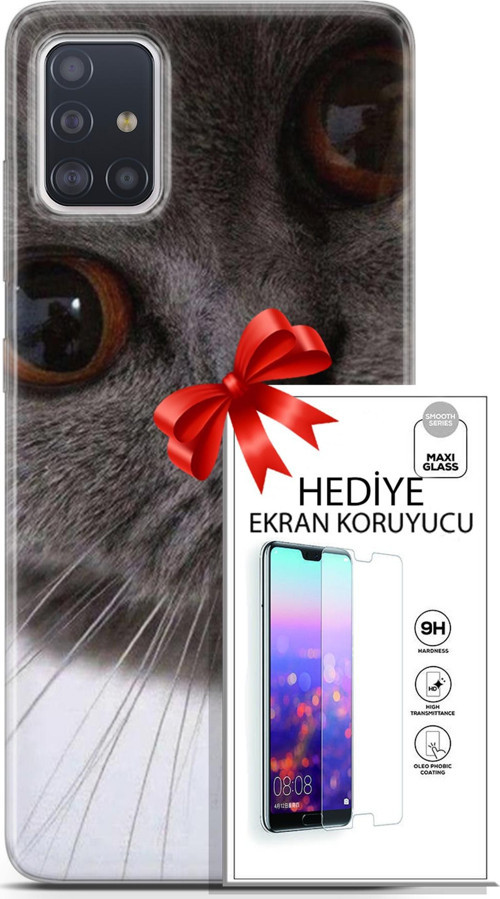 Samsung Galaxy A71 Kılıf Orijinal Seri Scotish-British 11 Pov British 4K Baskılı Kılıf + Ekran Koruyucu