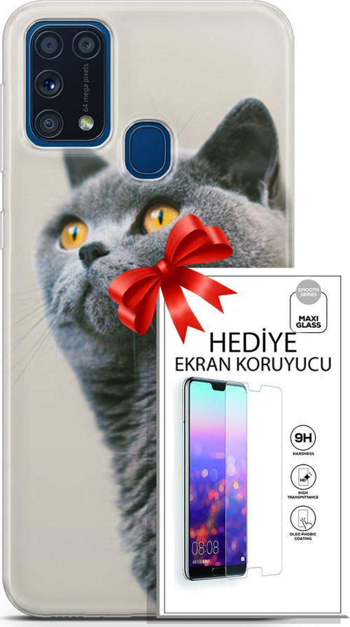 Samsung Galaxy M31 Kılıf Orijinal Seri Scotish-British 05 Gri Scottish Koruma Kılıfı + Ekran Koruyucu