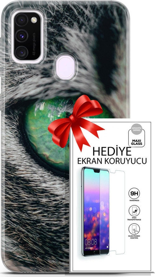 Samsung Galaxy M21 Kılıf Orijinal Seri Scotish-British 28 Göz Detay İz Bırakmayan Kılıf + Ön Ekran Koruyucu