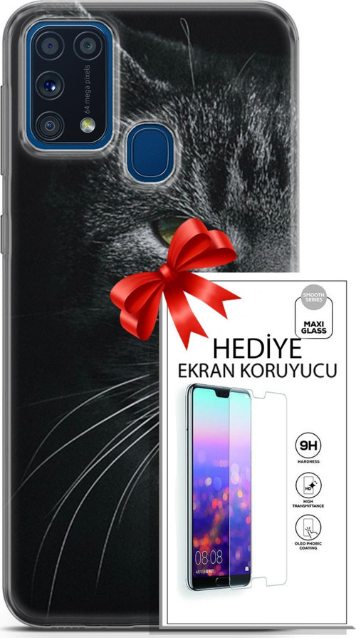 Samsung Galaxy M31 Kılıf Orijinal Seri Scotish-British 24 Asi Kedi Darbe Emici Kılıf + Ekran Koruyucu