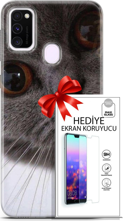 Samsung Galaxy M21 Kılıf Orijinal Seri Scotish-British 11 Pov British 4K Baskılı Kılıf + Ekran Koruyucu