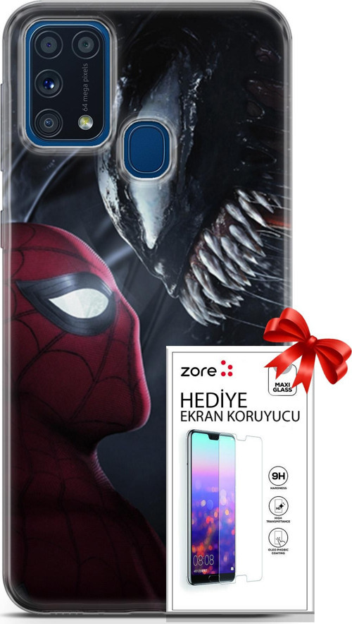 Samsung Galaxy M31 Kılıf Orijinal Seri Supers 09 Spider-Man Vs Venom Uv Kılıf Ve Ekran Koruyucu