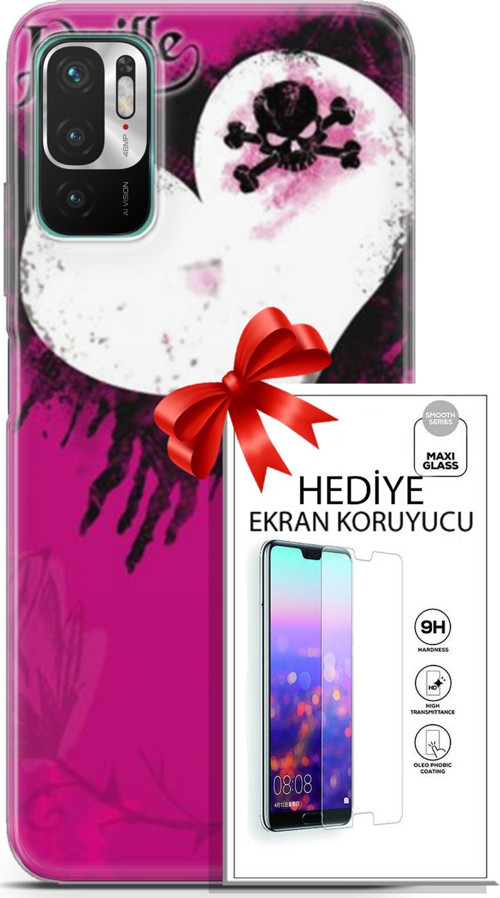 Xiaomi Redmi Note 10 5G Kılıf Orijinal Seri Punky 27 Jaxville Lazer Kesim Silikon Ekran Koruyucu
